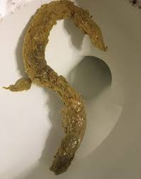 Research has shown that there is a significant delay between when people notice signs of colon cancer and when it is actually diagnosed. Terrified Of Colon Cancer Anyone Wit Colon Cancer Conn