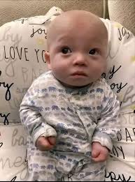 Frustration with hospital system regarding son's frequent hospitalizations  and oxygen treatment