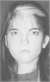 Absence of a vagina and right sided adnexa uteri in the Waardenburg  syndrome: a possible clue to the embryological defect