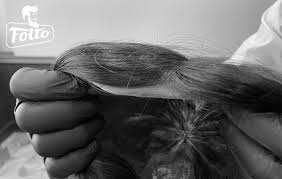 Il mercato è estremamente ampio e vario, posso dirti che puoi trovare protesi da 100€ fino a un massimo . Protesi Per Capelli Quanto Costa Qual E Il Giusto Prezzo