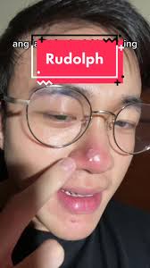 Merry Christmas sa inyong lahat #rudolphtherednosereindeer #marthstone  #skincare