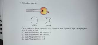 Maka jarak terdekat yang dapat dilihat orang tersebut tanpa kaca mata adalah …. Cacat Mata Dan Lensa Kacamata Yang Digunakan Agar Digunakan Agar Bayangan Jatuh Tepat Di Retina Brainly Co Id