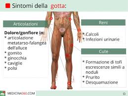 La misura della quantità di acido urico presente in circolo si chiama uricemia. Gotta Sintomi Cause Dieta E Rimedi Per La Malattia