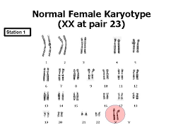 We did not find results for: Karyotyping Notes And Activity Pages Why Do Scientists