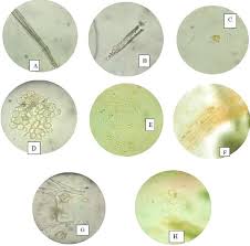 Image result for Struchium sparganophorum