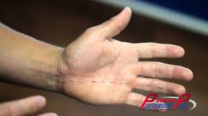 Pinky finger pain or little finger pain from a sore or jammed pinky finger needs massage for the ligaments to heal. Numbness In Fingers Hand Huntington Beach Chiropractor Chiropractic Clinic Orange County Youtube