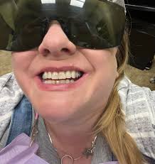 Went to the dentist today and he was taking pictures of my teeth and gums.