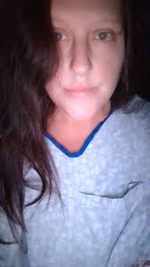 Man who lost both hands and one foot trying a basketball slam dunk says he  didn't feel any pain when it happen