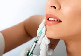 Lip Fillers in Dubai | Lip Augmentation and Enhancement Treatment