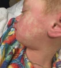 It was just really debilitating': Sun Prairie mom recounts her young  daughter's harrowing fight against MIS-C