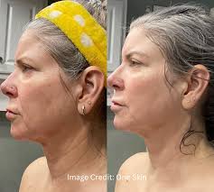 ONESKIN & SPA SKIN & BEAUTY