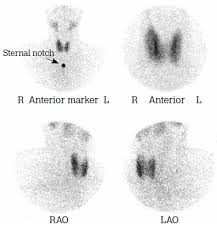 Racgp Thyroid Scans