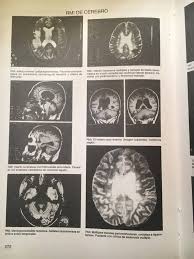Check spelling or type a new query. Un Poco De Semiologia Semiologia Medica Fisiopatologica Facebook
