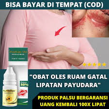 Sakit kepala sebelah kiri bisa disebabkan gaya hidup tak sehat sampai penyakit tertentu. Obat Ruam Di Bawah Payudara Obat Gatal Payudara Ruam Lipatan Payudara Puting Lecet Luka Gatal Berdarah Payudara Bengkak Panas Sering Terasa Sakit Bernanah Iritasi Kulit Benjolan Payudara Kurap Abses Payudara