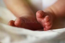 Approximately 50% of cases of clubfoot affect both feet. 185 Clubfoot Photos Free Royalty Free Stock Photos From Dreamstime
