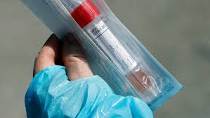 Sometimes false negatives result from human. Two New Covid 19 Cases In Middlesex London Three In Huron Perth 1 In Grey Bruce Ctv News