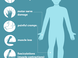 Peripheral neuropathy caused by toxic substances or medications can often be corrected in much the same way. Understanding Peripheral Neuropathy