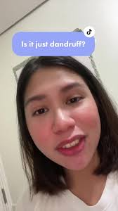 Bringing awareness to this skin condition na napaka common pala — if you  have the means, try getting checked by a derma! #adulting #dermatologist