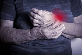 Woods developed arthritis after having knee surgery for a torn acl. When Rheumatologists Use Corticosteroids In Rheumatoid Arthritis