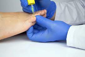 Does hand sanitiser kill viruses? How To Get Rid Of Ringworm