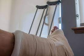 How To Reduce Swelling After Foot Surgery [7 Simple Tips]