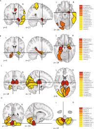 Maybe you would like to learn more about one of these? Evolution Of Genetic Networks For Human Creativity Molecular Psychiatry
