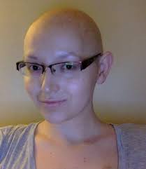 A type of targeted cancer drug called epidermal growth factor receptor (egfr) inhibitors. 2 Years Of Hair Growth After 5 Months Of Chemo Album On Imgur