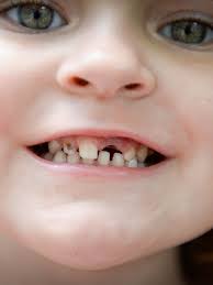 Shattered smiles: Florida kids face dental crisis