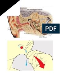 Timpanul este protejat de praf si de alte particule de catre ceara din urechi. Desfundarea Urecholor Dupa Inot