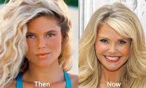 It's more than just breast augmentation and rhinoplasty. Christie Brinkley Plastic Surgery With Before And After Photos