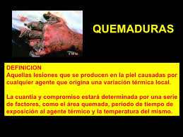 Resultado de imagen para QUEMADO significado