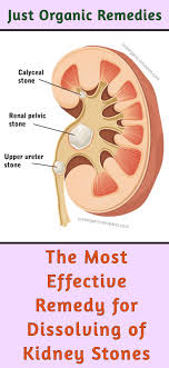 Kidney Or Gallbladder Stones Are Quite Common Today And Many People Seek For Natural Remed Gallbladder Stones Holistic Health Remedies Cold And Cough Remedies