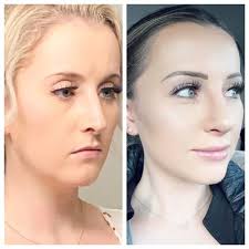 JMISKO SURGICAL DESIGN MD