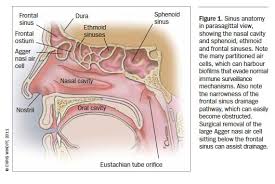 Image result for Sinusitis Prediction Rule