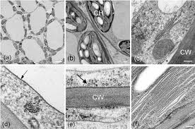 We did not find results for: Details Of Cell Ultrastructure From Plant Leaf Cells A D Show Download Scientific Diagram