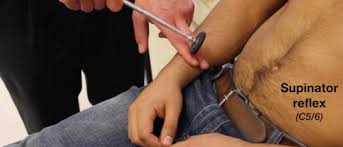 Image result for Supinator Reflex