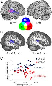 Maybe you would like to learn more about one of these? Differentiating Hemispheric Contributions To Syntax And Semantics In Patients With Left Hemisphere Lesions Journal Of Neuroscience