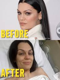 Jessie J Hospitalized With Infection Six Weeks After Breast Cancer Surgery  😱💔 British pop star Jessie J is facing another health scare less than two  months after undergoing surgery for breast cancer.