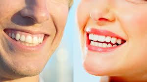 Need a dentist in milton keynes? Cosmetic Dentistry West Kelowna Dr Shauna Palmer