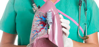 Other than the early warning signs and symptoms of lung cancer listed above, there are a few other less common symptoms that might. Warning Signs Of Lung Cancer Ut Health East Texas Hope Cancer Center