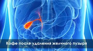 диета после удаления желчного пузыря через 1 5 месяца Mozhno Li Upotreblyat Kofe Pri Pankreatite Sovety I Ogranicheniya