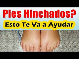 Pin En Remedios Caceros
