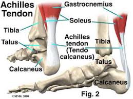This diagram depicts knee tendon diagram and explains the details of knee tendon diagram. Achilles Tendon Rupture Morgan Hill Foot Pain Los Gatos Santa Clara County Ca