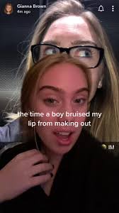 Bitten Lip Swollen: Why Do My Lips Get Bigger After Kissing?