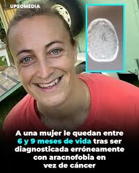 En 2015, la ex futbolista inglesa, Amy Carr, sufrió un colapso cuando se  encontró una araña en su propia habitación. Tras lo ocurrido, los doctores  la examinaron y descartaron el episodio como