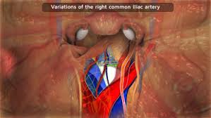 Check spelling or type a new query. The Anatomy Of The Sacral Promontory How To Avoid Complications Of The Sacrocolpopexy Procedure Sciencedirect