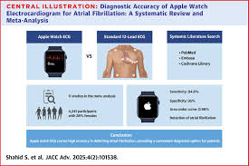 Image result for Electrocardiogram Validity