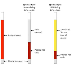 an illustration to show how pcv is measured in capillary