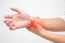 Both can cause an angulation where the fingers meet the hand, with the fingers angled toward the side of the little finger. Studies Show How Type 1 Interferon Levels Correlate With Age And Ethnicity In Systemic Lupus Erythematous Pharmaceutical Processing World
