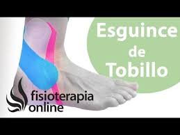 Esguince De Tobillo Mal Curado O Cronico Fisioterapia Online Esguince De Tobillo Esguince Fisioterapia